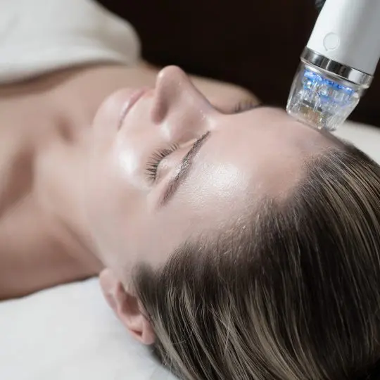 Secret RF anti-aging face treatment