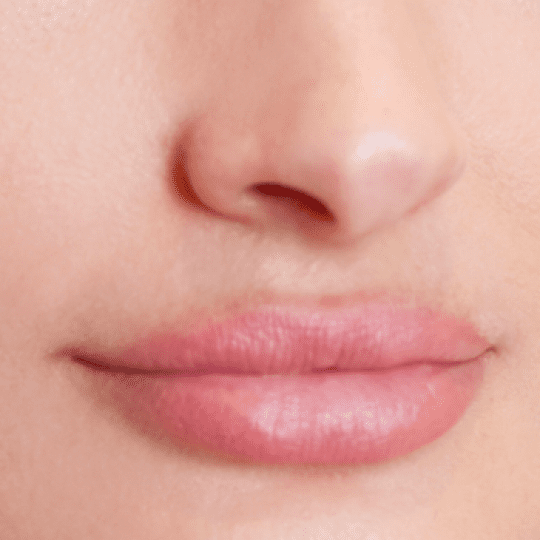 Personalized hair removal services on the lips At Rescue Spa